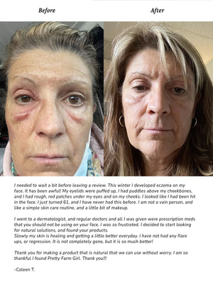 Pure + Simple Skin Kit for Sensitive Skin